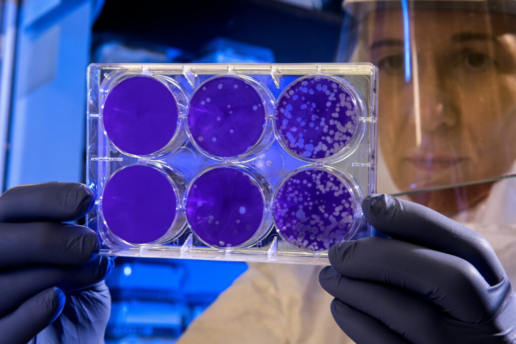 sibo mixto sobrececimiento bacteriano